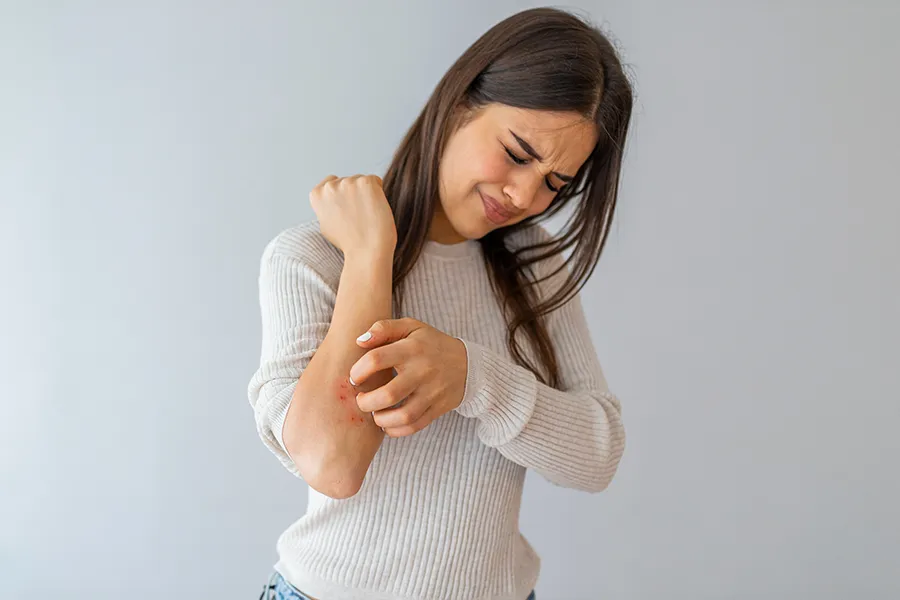 Eczema-Clinic A young brunette woman scratches her forearm and winces in discomfort. Get treatment for eczema from Sandra McDonald, NP in Southwestern Ontario.