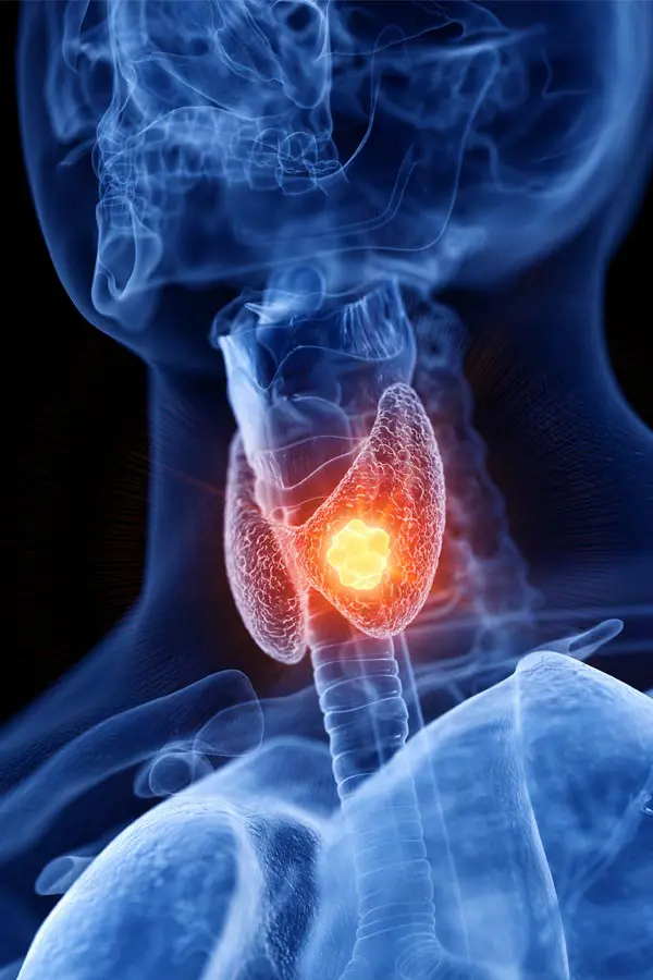 Thyroid-Imbalance-Treatment A 3D illustration of an x-ray of a human neck, highlighting the thyroid. Get help with thyroid imbalance from Sandra McDonald, NP in Southwestern Ontario.